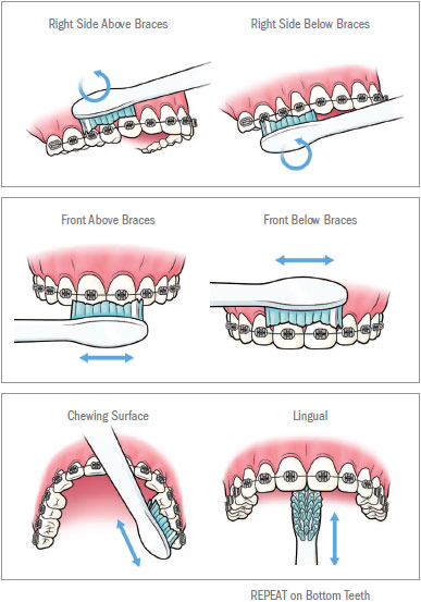 How Long Should You Brush Your Teeth? Plus, Other Brushing FAQs